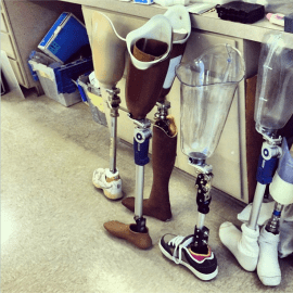 Prostheses! It is imparitive that these fit exactly, and sometimes multiple devices will have to be created just for the fitting process. The plastic is thermoset plastic, which starts as a liquid and is impregnated with fabric. The inside is made of carbon fiber for added strength.